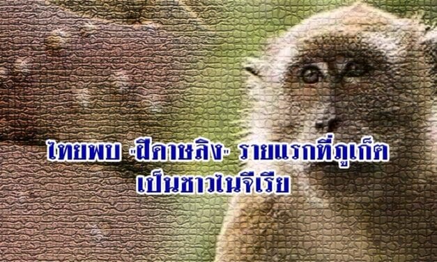 ด่วน‼️ไทยพบ “ฝีดาษลิง” รายแรกที่ภูเก็ต เป็นชาวไนจีเรีย