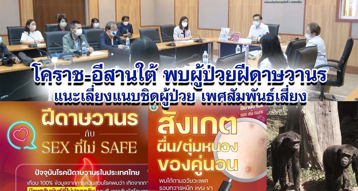 โคราช-อีสานใต้ พบผู้ป่วยฝีดาษวานร9ราย แนะเลี่ยงแนบชิดผู้ป่วย เพศสัมพันธ์เสี่ยง